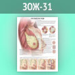 Плакат «Что такое рак груди?» (ЗОЖ-31, ламинир. бумага, А1, 1 лист)